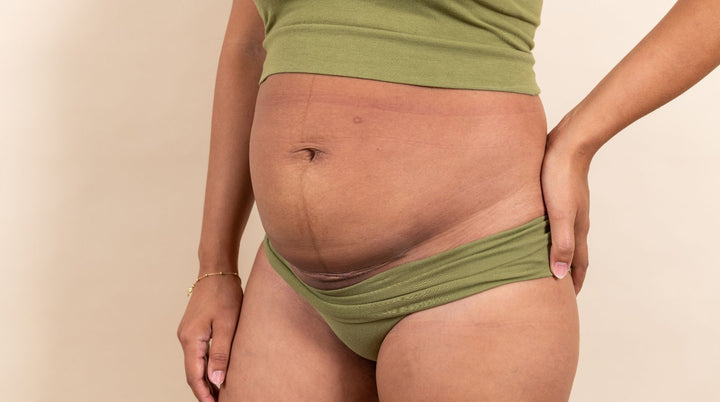 Image of mom with c-section scar.